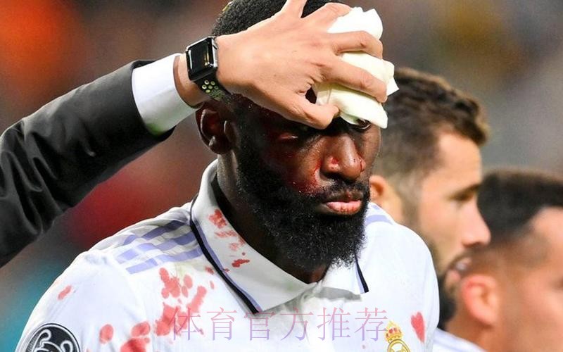 球衣全是血!皇马英雄95分钟舍身绝平 赛后缝20针